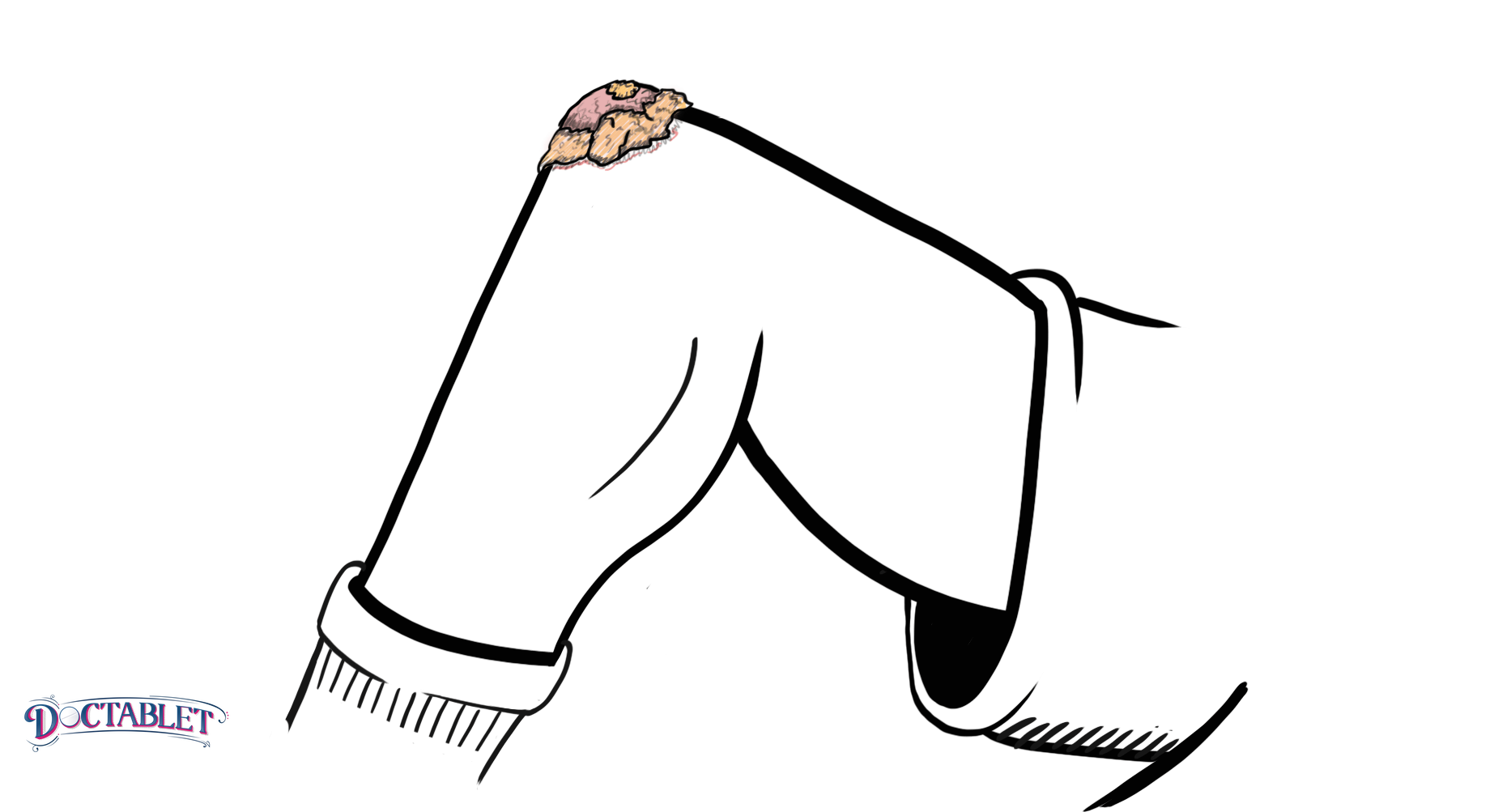 ¿que es la enfermedad del corazón?