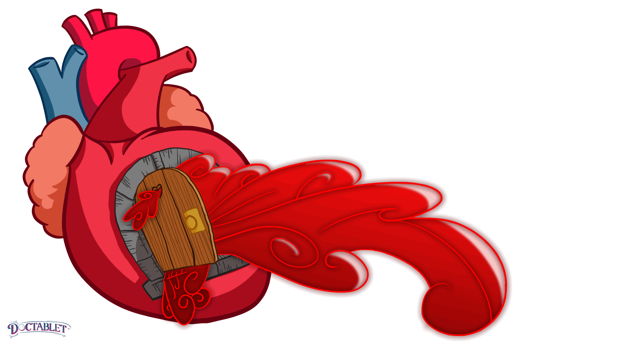 Válvula estenótica no abre como debe.