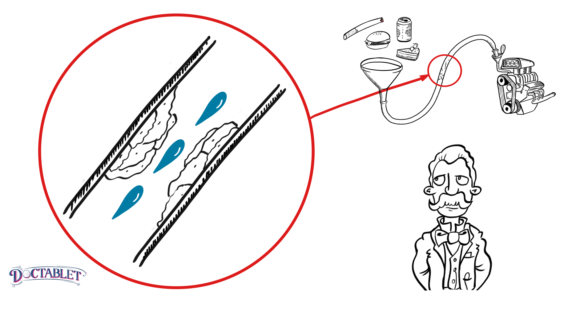 What causes a heart attack? blockages fall apart