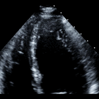 Heart at rest in a stress echocardiogram