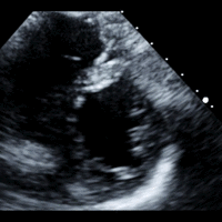 Heart at rest in a stress echocardigram