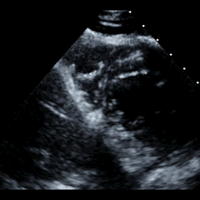 Heart at rest in a stress echocardiogram